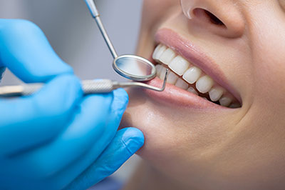 Dental Checkups in Burlington