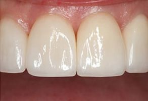 Bellemont dental images