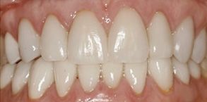 dental images 27215