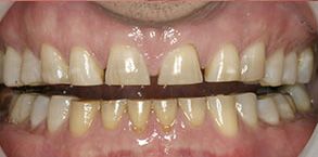 Burlington dental images
