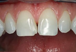 Dental Images near Green Level